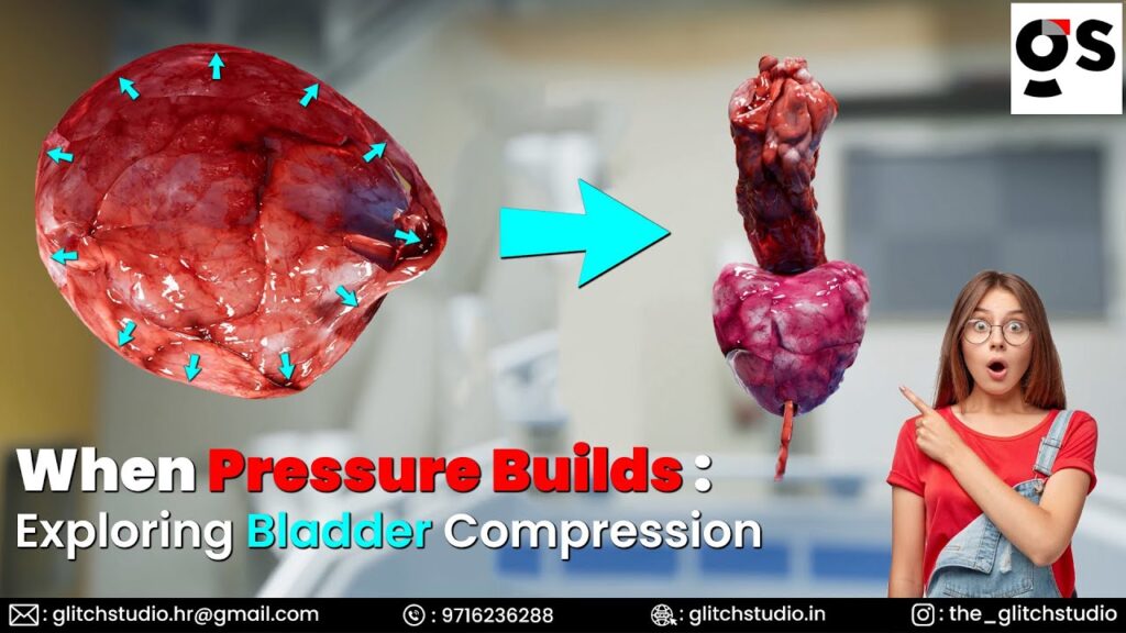 Bladder decompresion